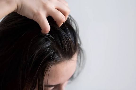 6 Antioksidan Untuk Rambut